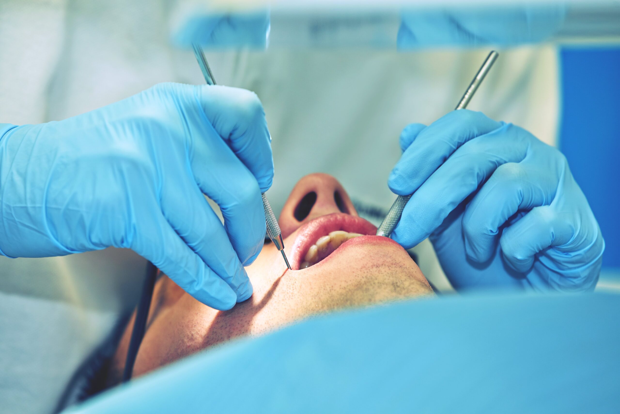 Rehabilitación oral